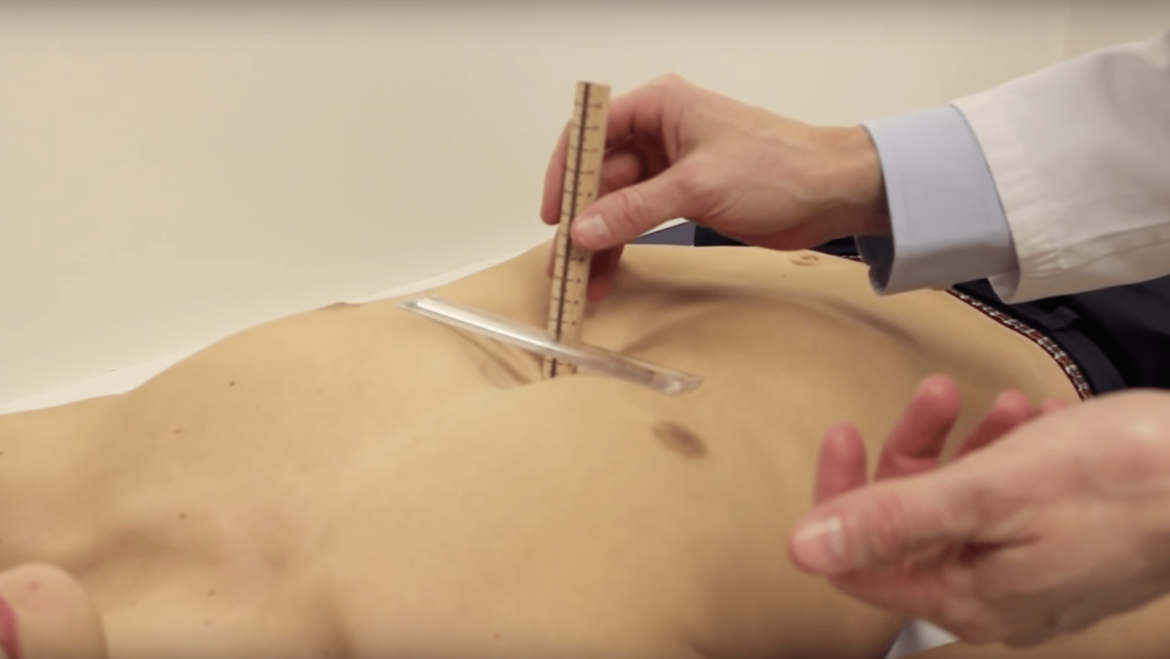 Vacuum Bell in the Children’s Hospital.
